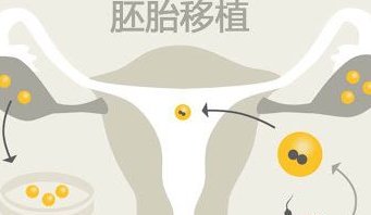 2026在蛟河市罗氏易位能做三代试管婴儿生子吗，相互易位和罗氏易位有什么区别？